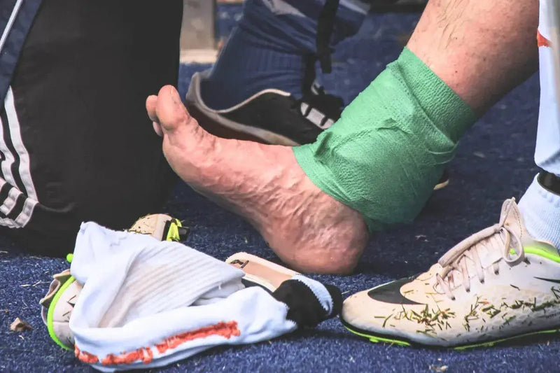 How to Avoid Ankle Fusion Surgery: Non-Surgical Alternatives for Ankle Arthritis Umicellar