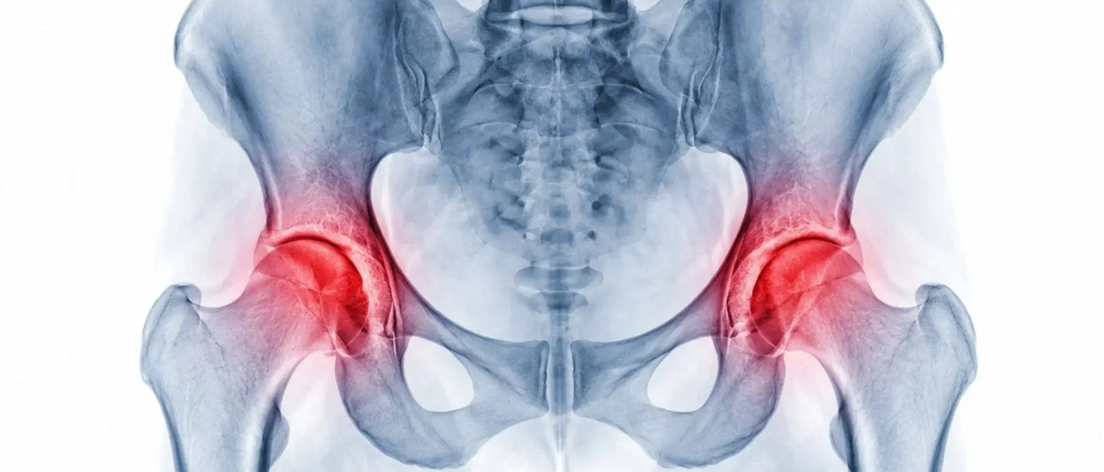 Osteopenia: What It Means and What to Do About It