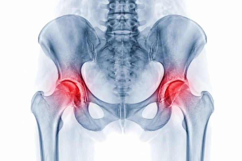 Osteopenia: What It Means and What to Do About It