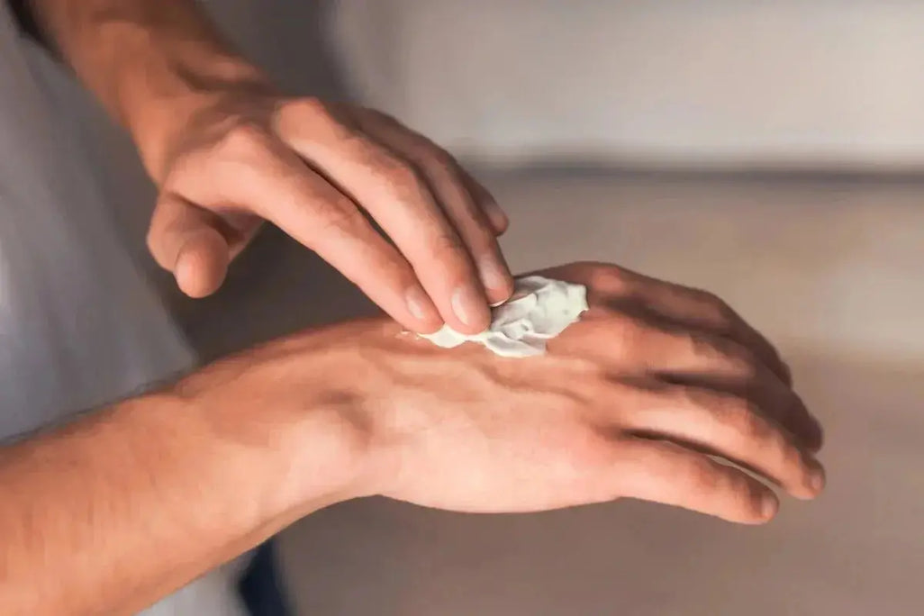 Best Cream for Arthritis in the Hands and Fingers (2026): What Actually Works Umicellar