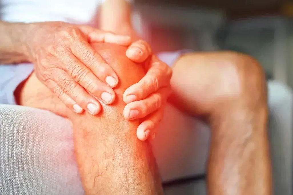 Best Cream for Osteoarthritis (2026): An Evidence-Based Comparison Umicellar