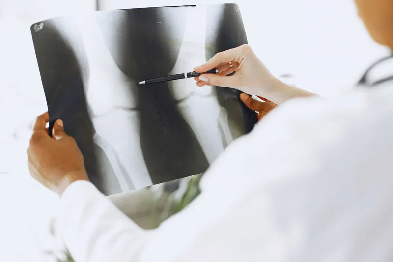 The Window Before Knee Replacement Surgery Most People Miss Umicellar