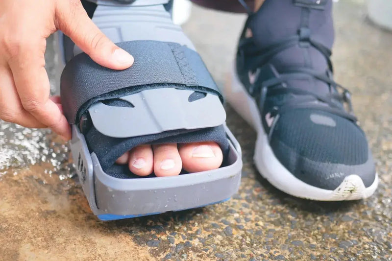 Can Big Toe Arthritis Be Reversed? Hallux Rigidus Causes and Non-Surgical Options Umicellar