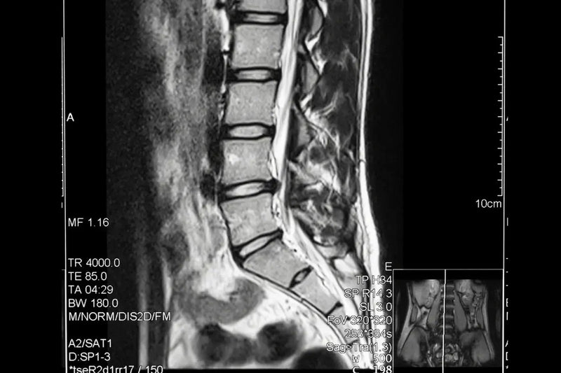 When Surgery Seemed Inevitable: One Patient's Three-Year Journey Without the Operating Room Umicellar