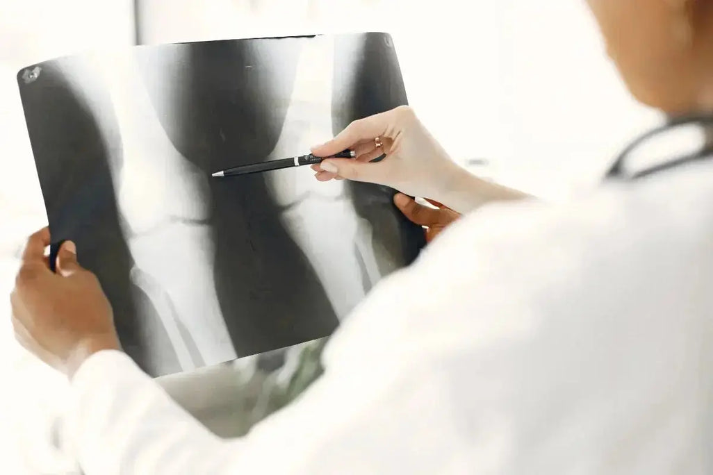 The Latest Osteoarthritis Research, Explained Umicellar