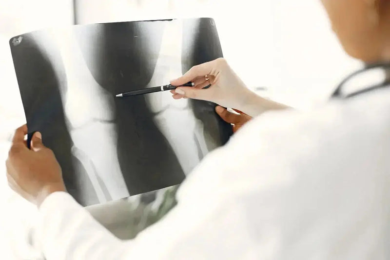 The Latest Osteoarthritis Research, Explained Umicellar