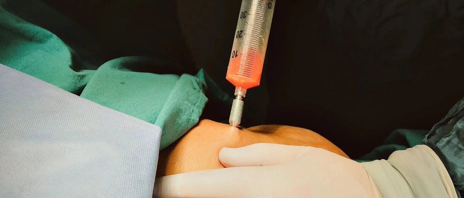 PRP Knee Injections: Do They Work — and Are They Worth the Cost?
