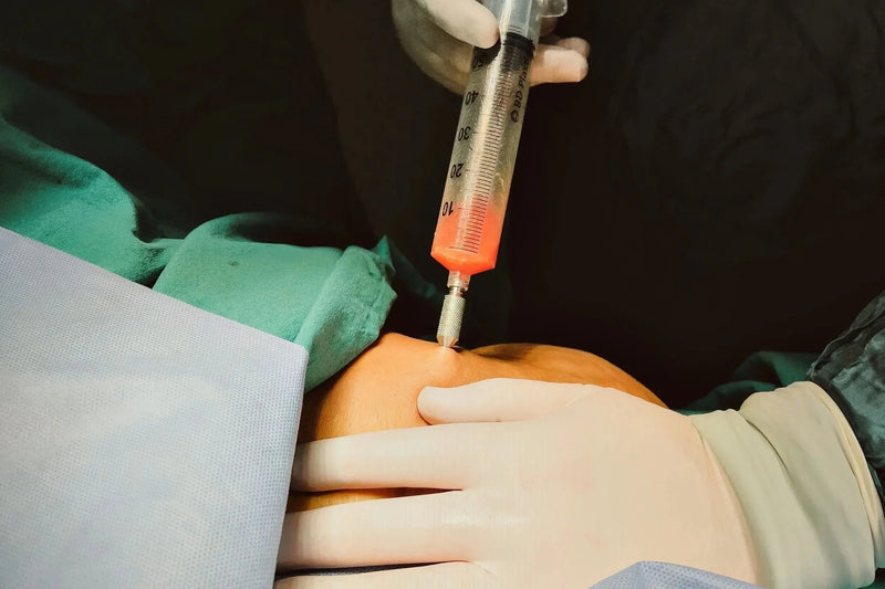 PRP Knee Injections: Do They Work — and Are They Worth the Cost?