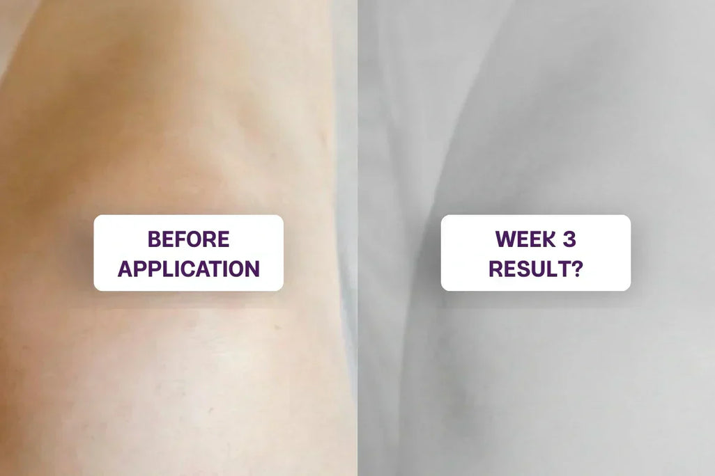 The Joint Cream That Ended Up Helping My Skin Too