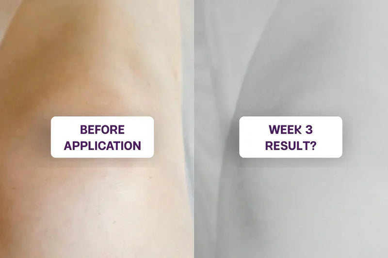 The Joint Cream That Ended Up Helping My Skin Too